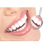 Teeth Whitening Kit 22% Carbamide Peroxide 10 Tooth Bleaching Gel
