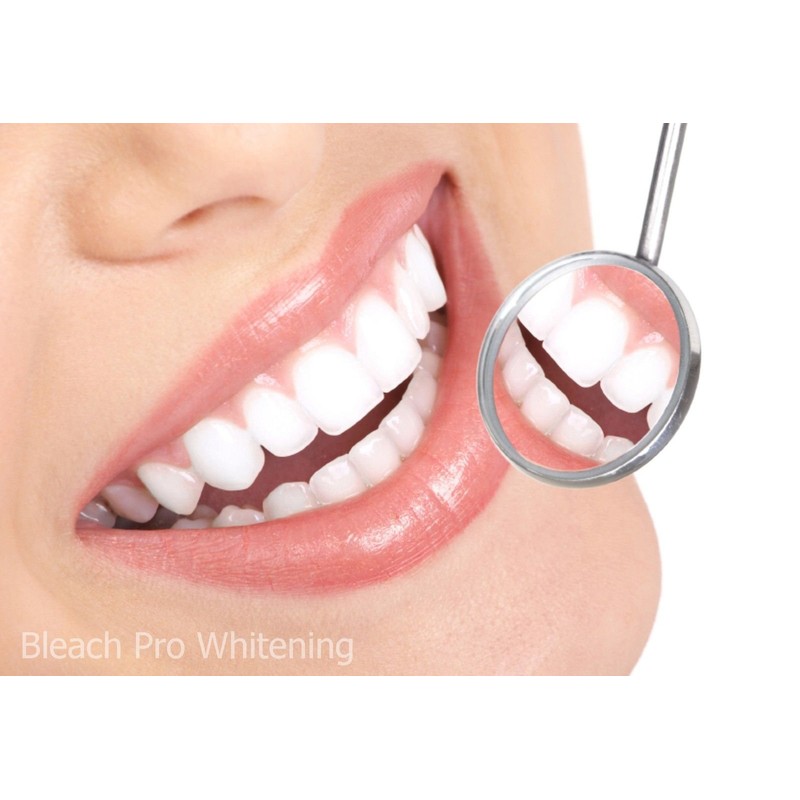 Teeth Whitening Kit 22% Carbamide Peroxide 10 Tooth Bleaching Gel