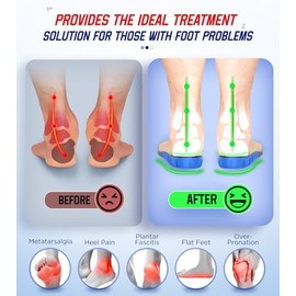 NEUPU Plantillas para fascitis plantar de más de 240 libras para hombres y mujeres, cómodas y resistentes plantillas de soporte de arco alto para aliv