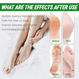 5 Pairs Foot Peel Mask for Hard Skin, Exfoliating Foot Peel Mask, Callus Remover, Aloe Deep Hydration, Nourishing, Repairing, for Daily Foot Care