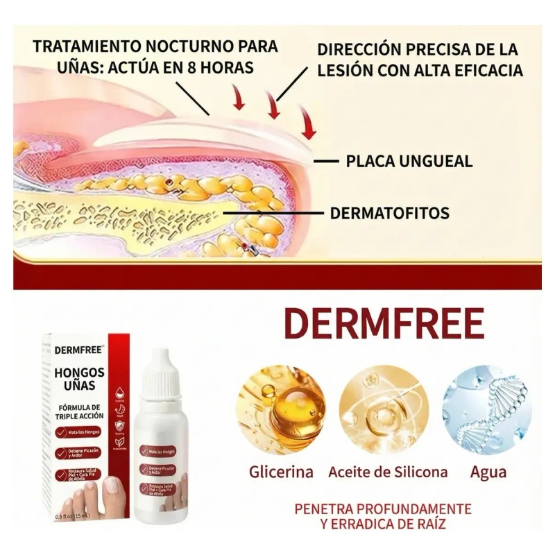 Solución Antifúngica Para Uñas, Pies Y Manos 15 Ml Blanco