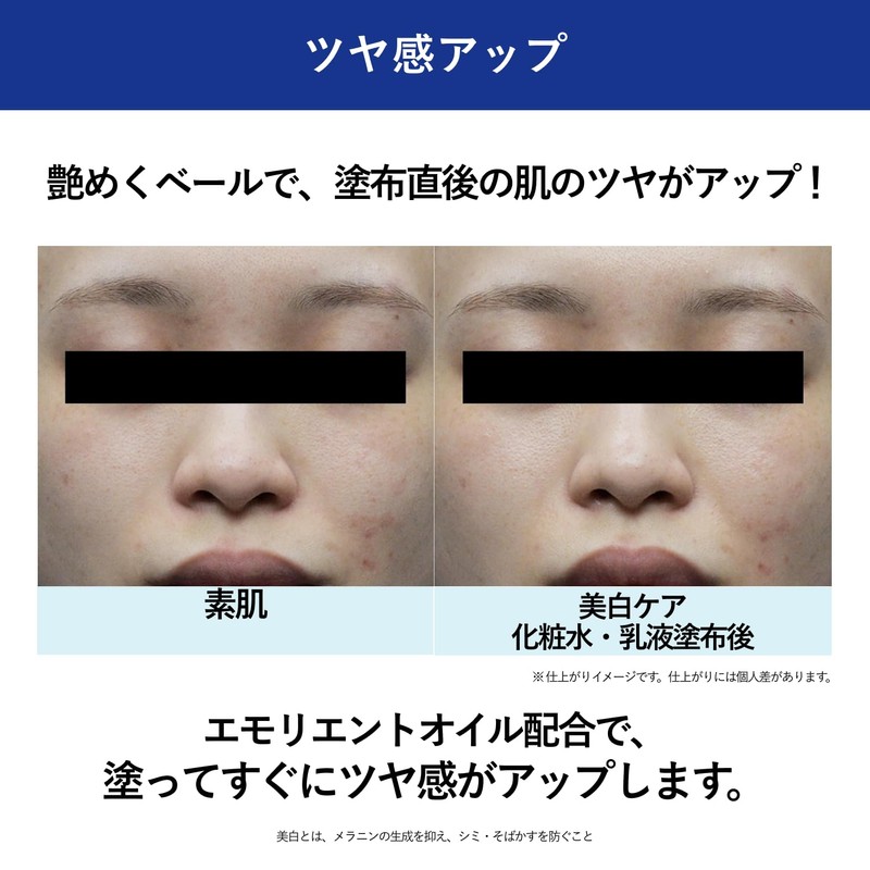 Aqua Label Treatment Lotion (Brightening), Very Moist Released February 24,