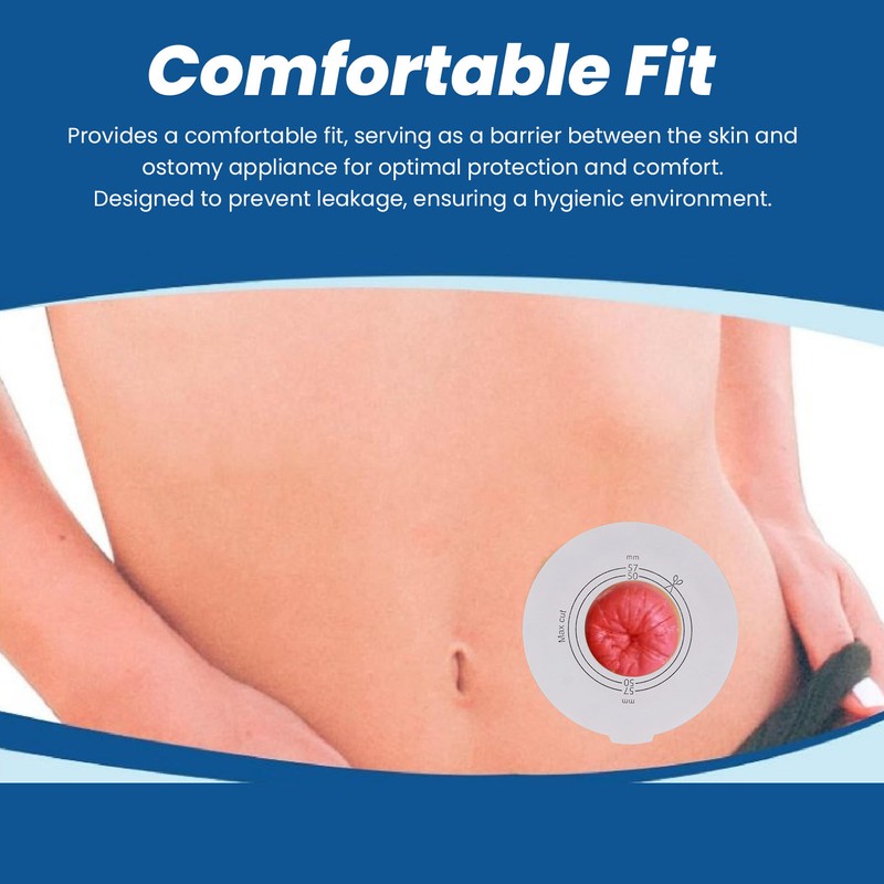 5Pcs Ostomy Barrier Ring Leakage Proof Versatile Ostomy Barrier Extender