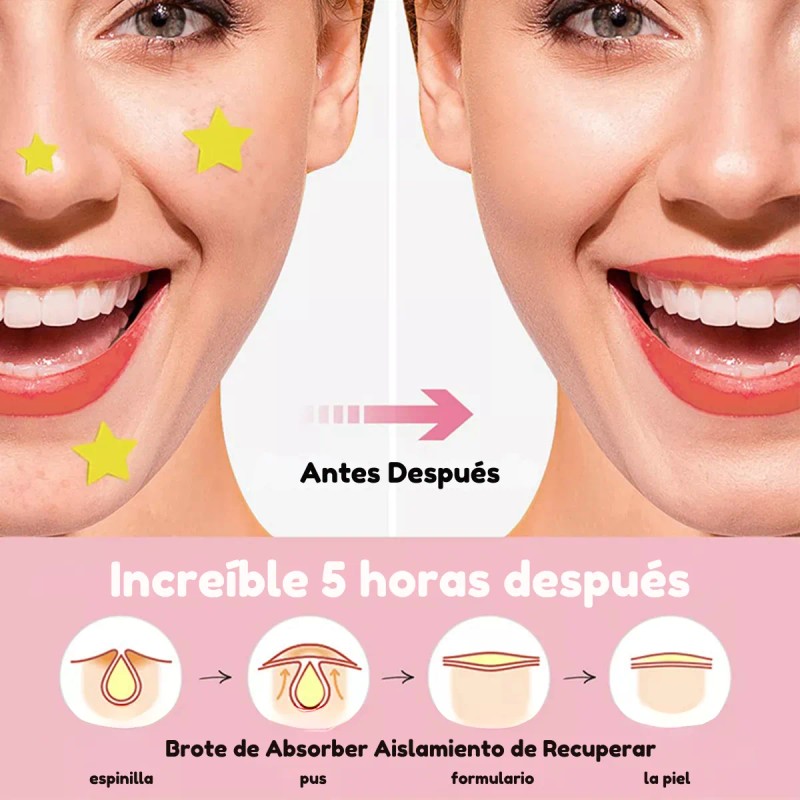 Parches Cuidado Facial Elimina