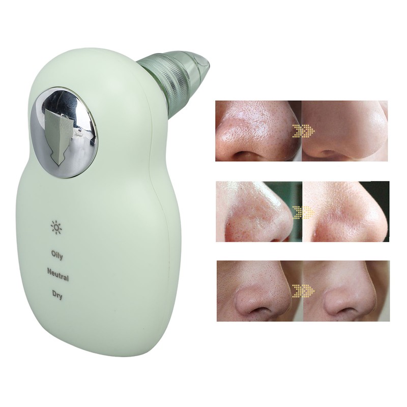 Heating Vacuum Blackhead Remover Gentle Micro Bubble 3 Suction Levels