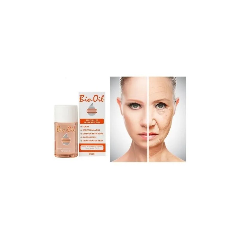 Bio Oil Aceite Corporal 125 Ml Cicatrices,estrías,envejecimi