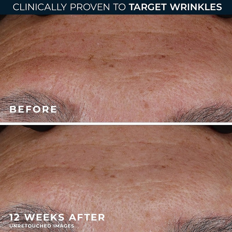 RoC Deep Wrinkle Serum, 1 Ounce