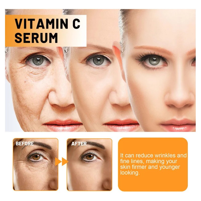 Un Tratamiento Facial Vitamínico Desaliniza Las Líneas Finas