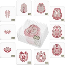 Timethink (Set of 10) 4'' 3D Brain Specimen Coasters, Funny Anatomic Brain Slices Square Acrylic Glass Drink Coasters Set for Neuroscience Medical Student Scientists Human Anatomy Gift Brain Decor