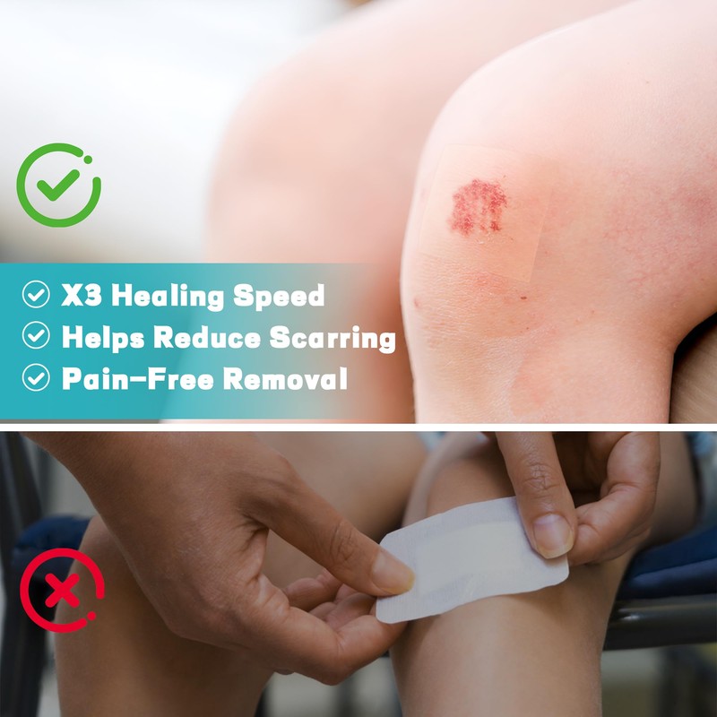 Hydrocolloid Roll for Wound Care - Medical Grade Hydrocolloid Bandages