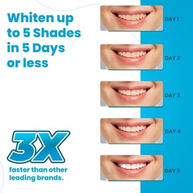 Lumist Teeth Whitening Strips – 10 Count Strips | Enamel-Safe Whitening Strip for Sensitive Teeth | Visible Teeth Whitening in 5 Days | Non-Slip Teeth Whitener Strips for Stain Removal