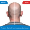 Neck Pad Compatible with CPAP Headgear Straps, Comfort Headgear Strap