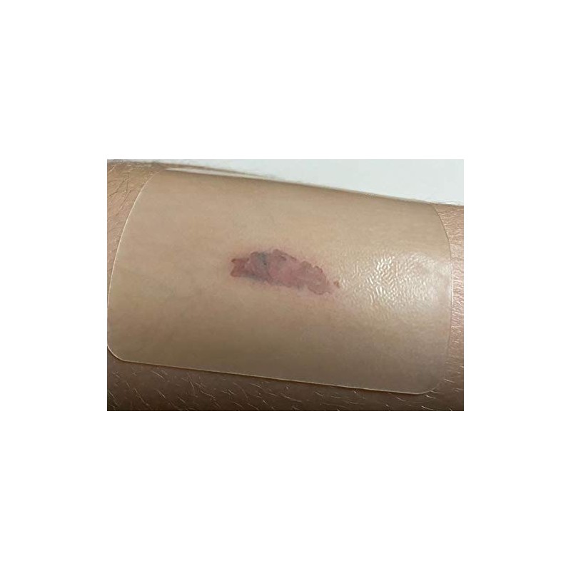 Extra Thin Hydrocolloid Sterile Wound Dressing 10cmx10cm x 5 (10cmx10cm)