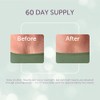 Silc Skin Almohadilla de escote para ayudar con las arrugas