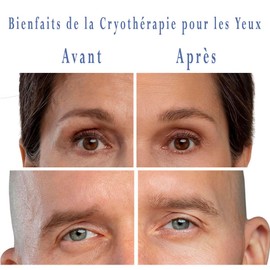 Cold Eye Mask | Gel Beads | Soothing | Concealer | Anti-Drink | Decongestant | Cold or Warm | Reusable as desired