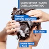 Uriage DS Hair Shampoo para la Caspa Severa con Ácido