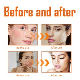 Turmeric Toner For Skin Protection And Moisturising, 100 Ml Toner Turmeric Brightening Face Toner Turmeric Face Toner Gently Removes Impurities, Repairs Dullness And Acne For All Skin Types