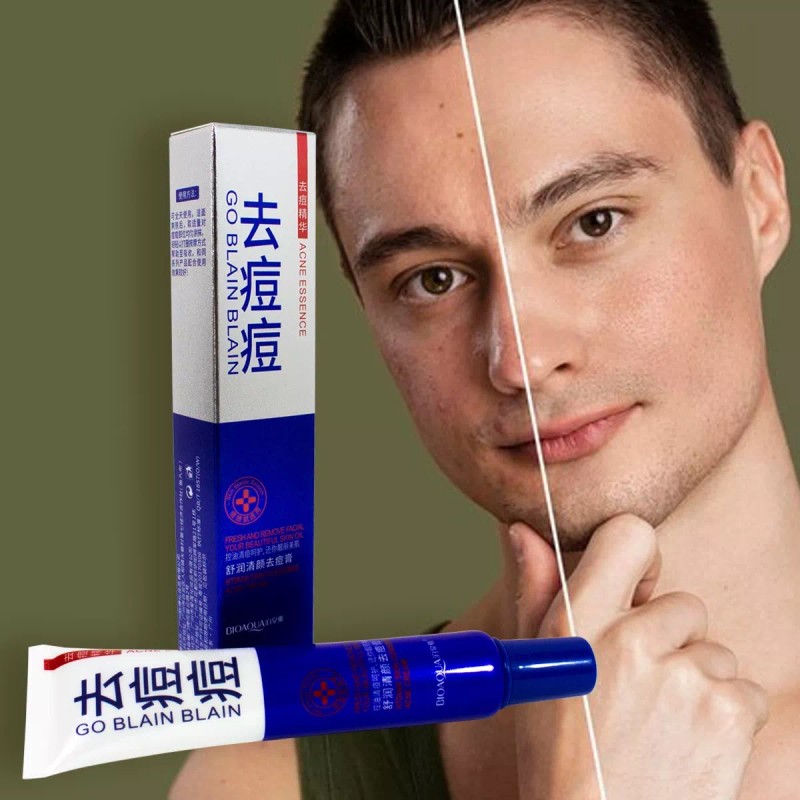 ANTI- ACNÉ Anti Acne Crema Cicatrices Cacarizos Grasa Tratamiento Piel