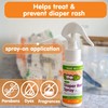 Boogie Diaper Rash Cream Spray for Baby, Travel Friendly No-Rub