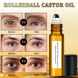 2 PCS Eye Essence Oil Roller Ball Castor Frankincense Rollerball