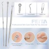 FEITA - Kit de herramientas para quitar espinillas, extractor de