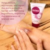Dermend Bruise Cream 2.5 oz.