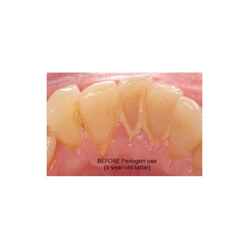 Periogen Periogen Complete Oral Health Rinse (3-PK)