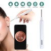 Z10 WiFi Ear Cleaning Endoscope High Definition Wireless Ear Camera