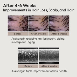 MINOXELL Scalp Intensive Shampoo - Peptide Shampoo Anti-Hair Loss Shampoo for Men Women Korean Hair Regrowth & Thickening with Panthenol Biotin, Paraben Free (13.52 fl oz)