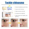 Crema Aclaradora De Día Y Noche Para Melasma, Pecas Y