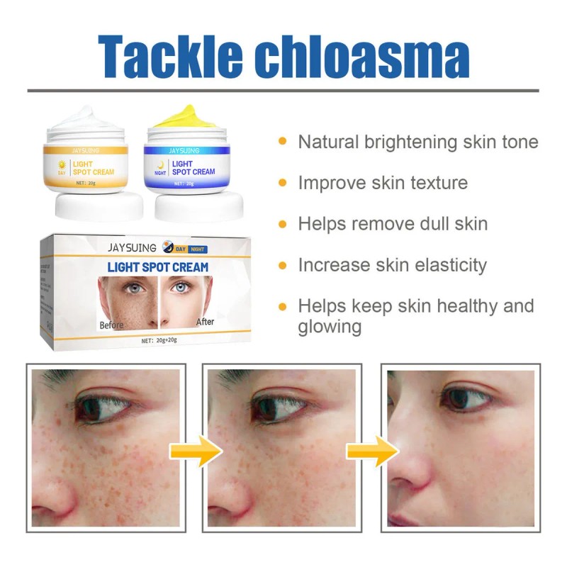 Crema Aclaradora De Día Y Noche Para Melasma, Pecas Y