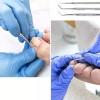 Universo en Linea 4pzs Herramienta Para Uñas Encarnadas Pedicura Profesionales