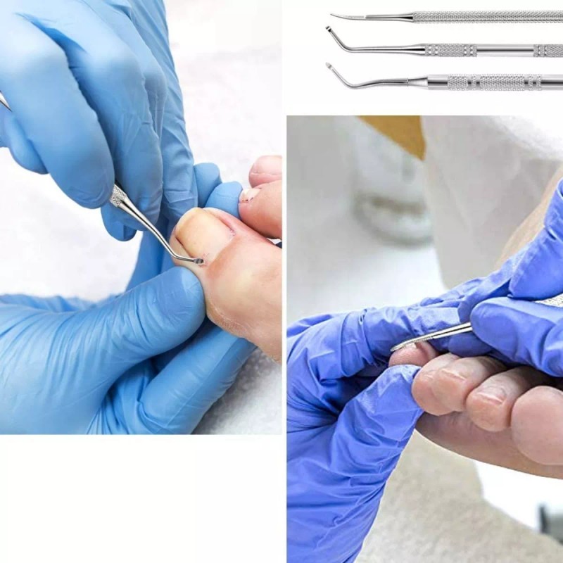 Universo en Linea 4pzs Herramienta Para Uñas Encarnadas Pedicura Profesionales