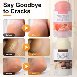 Urea Creme Fußpflegecreme Fußpflegecreme Lindert extreme Trockenheit und Rissbildung der Füße