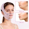 2 PCS Chin Strap for Double Chin V Line Face