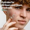 Cetaphil Crema Hidratante Facial Matificante Para Acné 89ml