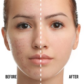 Catkin Catkin Phoenix Cushion Foundation Buildable Coverage Anti-Aging Serum Makeup, Sheer Satin Finish, Refill Included, Light Beige 0.46 Oz x 2, C01 Natural Beige