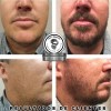 Bálsamo Potente Para Crecimiento De Barba Y Bigote Al 25%