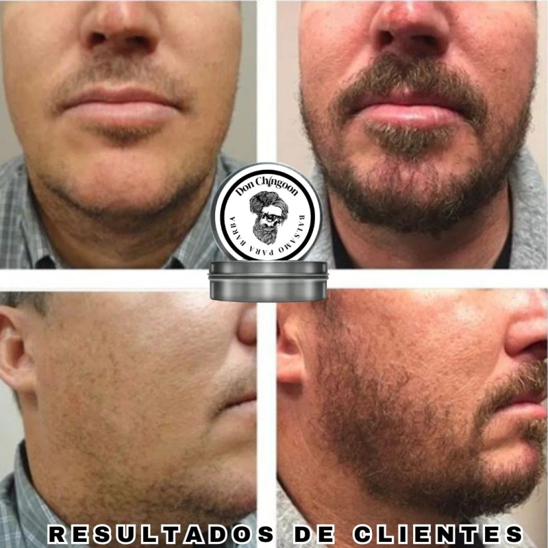 Bálsamo Potente Para Crecimiento De Barba Y Bigote Al 25%