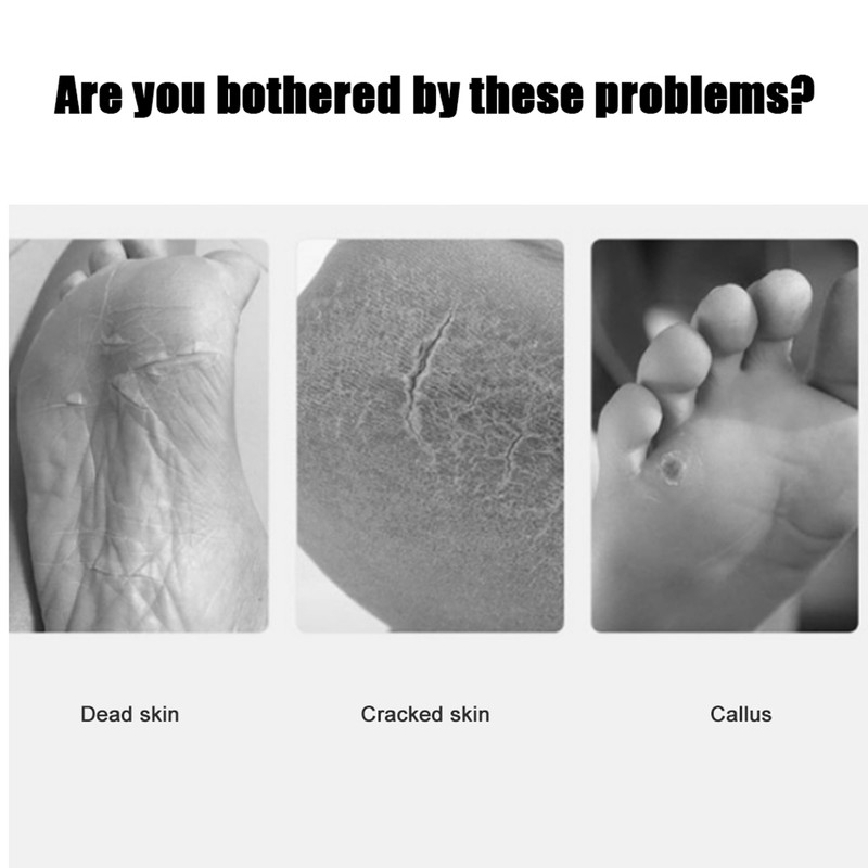 Electric Rechargeable Automatic Callus Remover Foot File Pedicure Tool 100‑240V