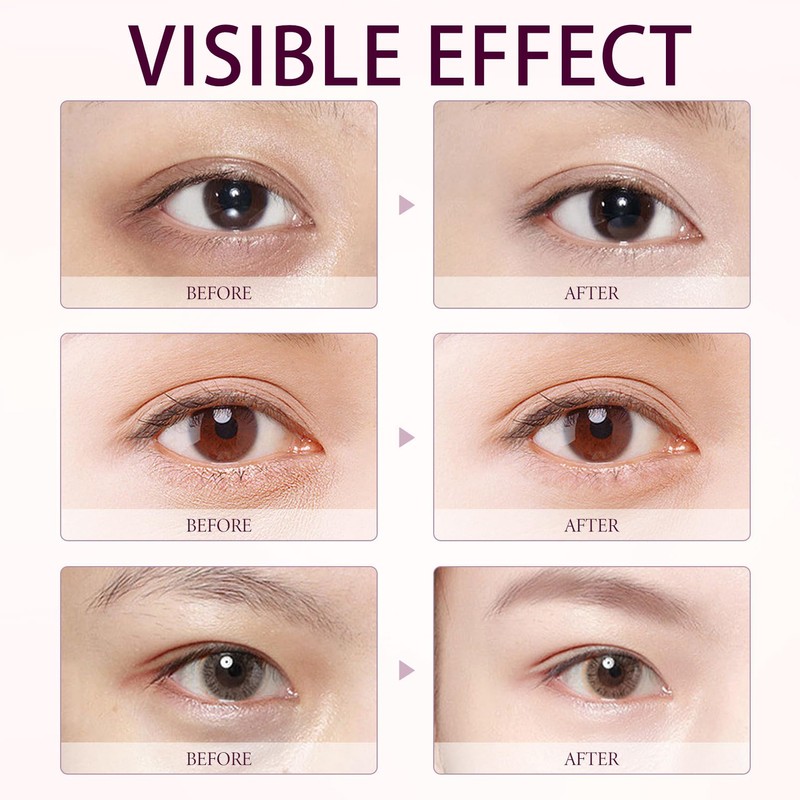 Eyelift Serum Mango Revitalize Eye Cream,Under Eye Cream for Dark