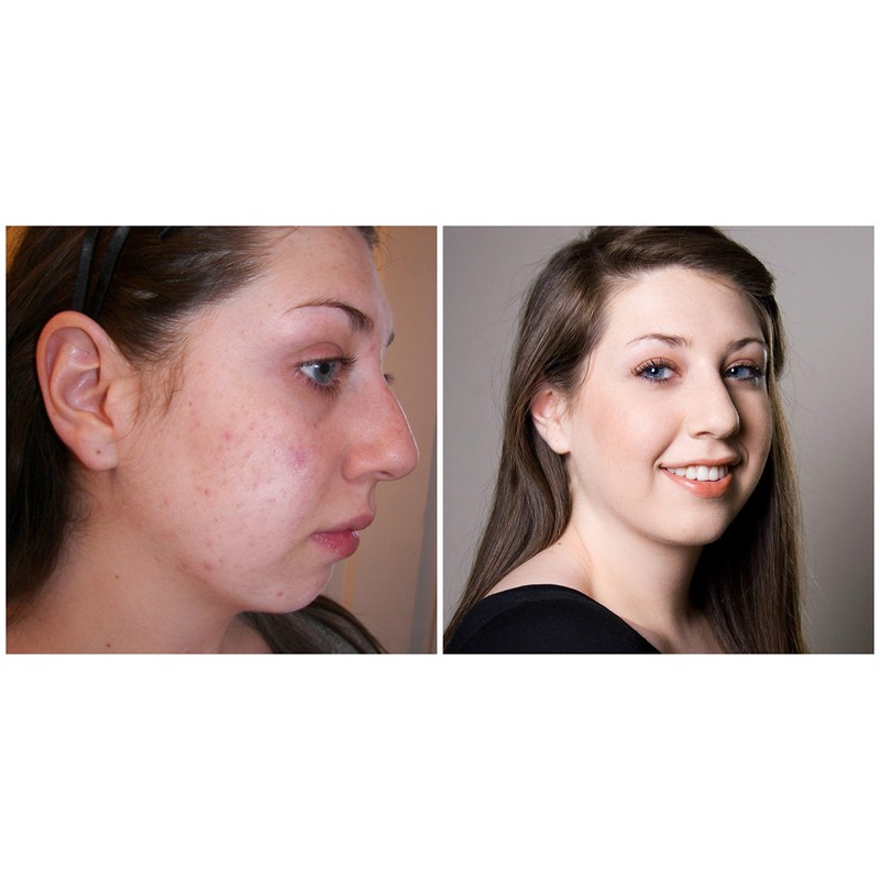 Judith August - EraseZit Deluxe Pencil - (Neutral)