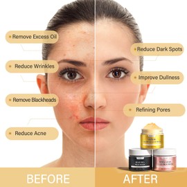 Vitamin C Turmeric Clay Mask, Dead Sea Mud and Himalayan Pink Clay Mask Set, Facial Skin Care Clay Mud Mask Hydrating Brightens Moisturizing Skin for Dull Skin, Blackheads, Enlarged Pores, Acne and Dark Spots