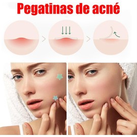 LUHI Parches para Acne, 200 Almohadillas Hidrocoloides para Espinillas, pads para acne, parches para acne, Parches para granos con forma de estrella, de amplia aplicación.(200PCS)