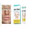 Crema Despigmentante Para Manchas,melasma, Acné Y Paño 2pzs