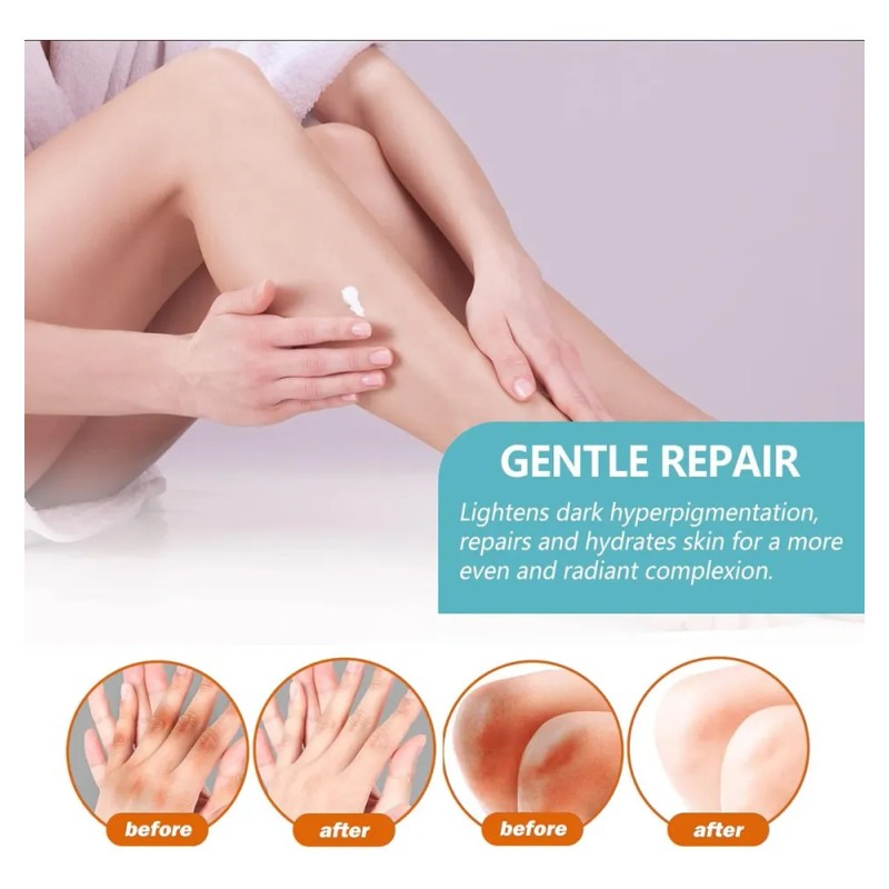 Crema Correctora Manchas Oscuras Hiperpigmentación, Vingtank