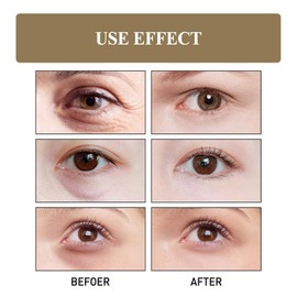 2PCS Seagrill Anti Wrinkle Serum,Anti-Aging Cream,Collagen Firming Serum,Eye Cream for Dark Circles and Puffy Eyes,Anti Wrinkles Essence,Dark Circles Under Eye Treatment Women,Under Eye Cream,Eye Gel