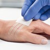 Omnistrip, Wound Closure Strips, Hartmann (3mm x 76mm)