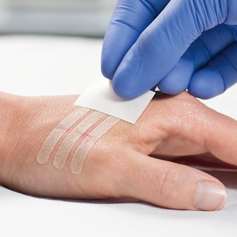 Omnistrip, Wound Closure Strips, Hartmann (3mm x 76mm)