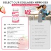 2 Pack Sugar Free Collagen Gummies for Women Men, 5000mg